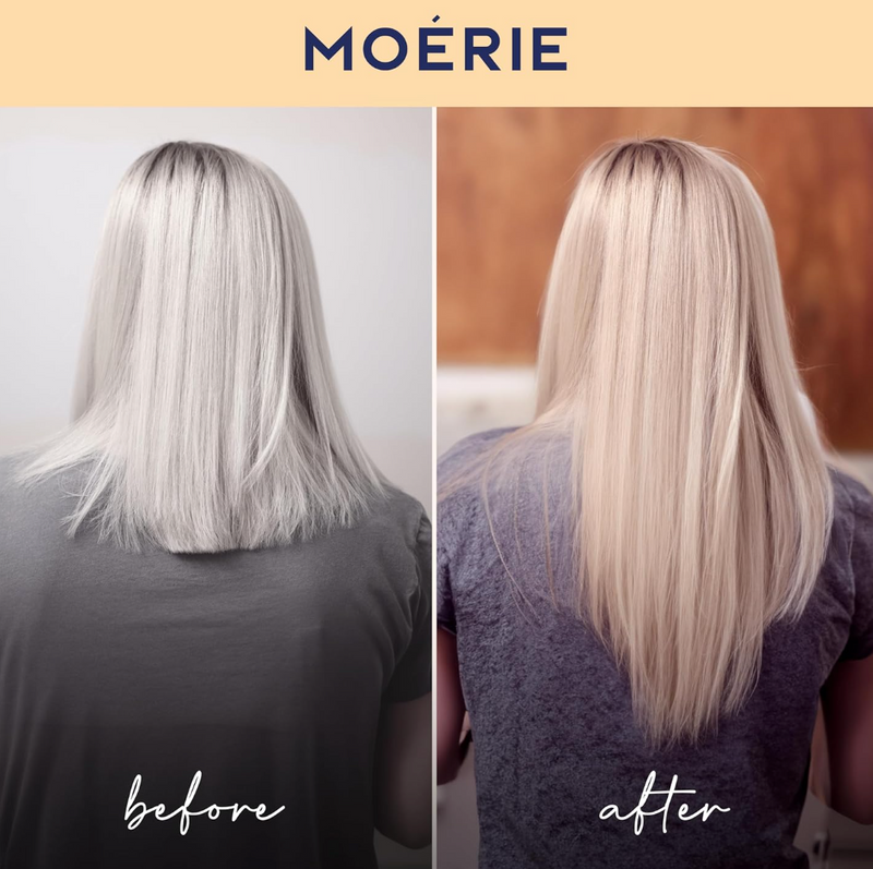 Moerie Volumizing Shampoo and Conditioner for Hair Loss - Thickening Products with Ingredients of Natural Origin - Over 100 Active Ingredients for Thick, Long, Luscious Hair, 2 X 8.45 Fl Oz