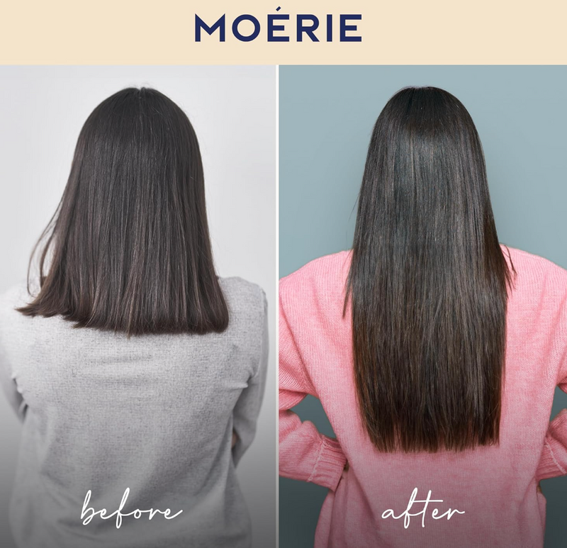 Moerie Volumizing Shampoo and Conditioner for Hair Loss - Thickening Products with Ingredients of Natural Origin - Over 100 Active Ingredients for Thick, Long, Luscious Hair, 2 X 8.45 Fl Oz